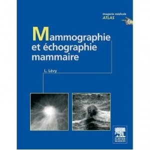 Mammography and breast ultrasound - Laurent Levy